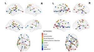 "Figure 5 (Jao et al., 2022) illustrates the significant changes in brain connectivity patterns"